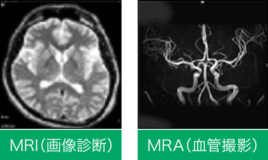 MRI(画像診断)・MRA(血管撮影)